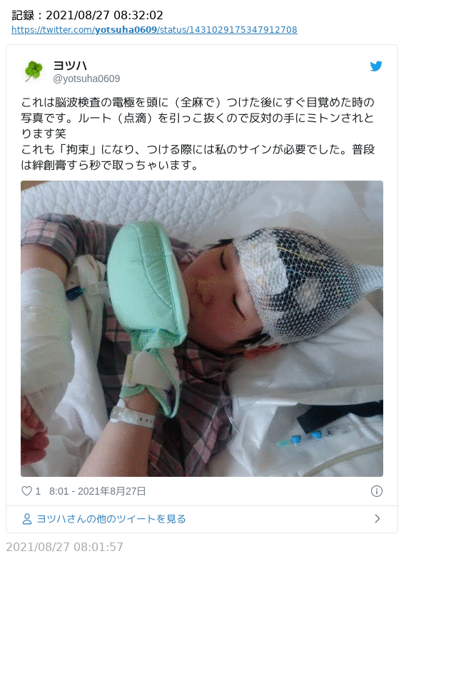 身体拘束の実態